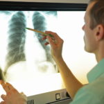Chronic Obstructive Pulmonary Disease 101